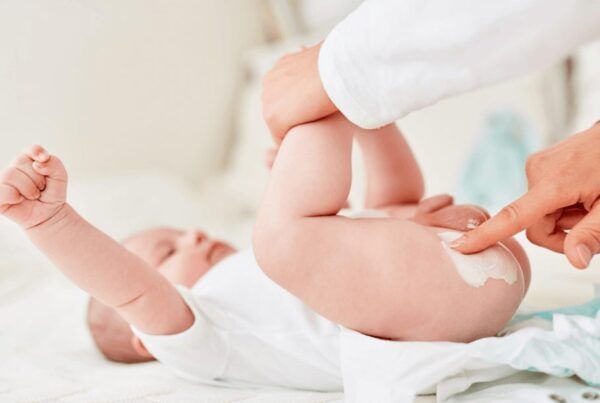 babys list Scalds in Babies: Diaper Discomfort