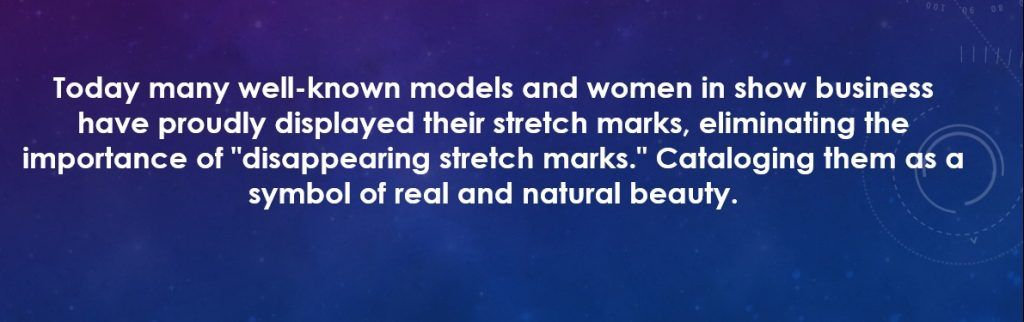 How to disappear stretch marks? Tricks of a mom