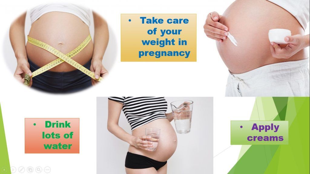 Get rid stretch marks